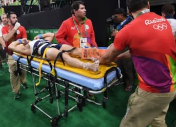 El gimnasta francés se fracturó la tibia de su pierna izquierda tras un mal salto. Sus compañeros no lo pedían creer. La peor imagen de Río 2016.