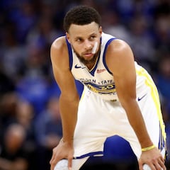 Stephen Curry podría perderse toda la temporada
