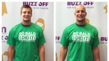 Rob Gronkowski antes y después del afeitado de cráneo.