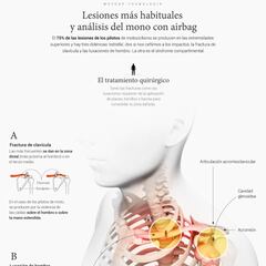 Lesiones más habituales y análisis del mono con airbag