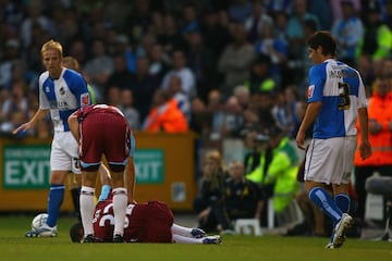 El inglés se rompió por dos partes la pierna en un partido de la Carling Cup ante el Bristol Rovers.