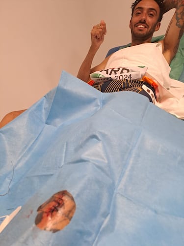 ¡°El tatuaje de la pierna ha parado la herida, ahora van a suturarme¡±