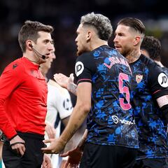 Una banda izquierda coja