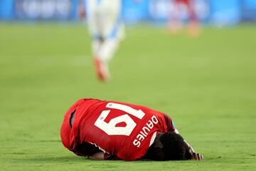 Canada's midfielder #19 Alphonso Davies gestures in pain during the Conmebol 2024 Copa America tournament semi-final football match between Argentina and Canada at MetLife Stadium, in East Rutherford, New Jersey on July 9, 2024. (Photo by CHARLY TRIBALLEAU / AFP)