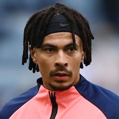 Dele Alli se queda sin Eurocopa