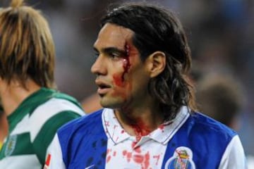 El jugador colombiano se ha caracterizado por luchar todos los balones y frente al Sporting sufrió una cortadura en su rostro. Esa imagen le dio la vuelta al mundo.