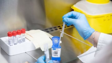 Cient¨ªficos en Nueva York consiguen curar a una mujer con VIH
