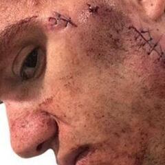 Tres partidos de sanción para Mané por su patada a Ederson