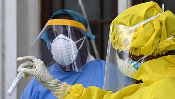 Coronavirus: ¿tener anticuerpos es lo mismo que ser inmune?