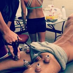 Las misteriosas manchas de Michael Phelps en Río