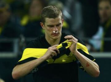 Sven Bender jugador del Borussia Dortmund sangrando por la nariz durante el partido contra el Napoles del grupo F de la Liga de Campeones