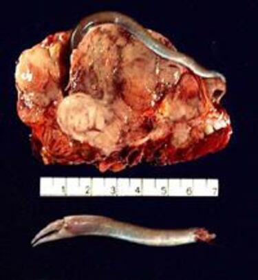 Sorprendente campaña publicitaria para Cold Fear