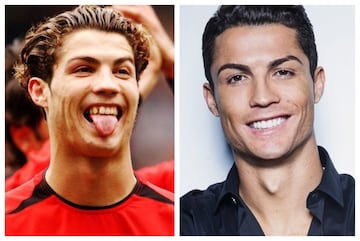 El futbolista portugu谷s, en sus primeros a?os en el Manchester United, ten赤a un aspecto en los dientes muy lejos de la perfecci車n que ha buscado en los 迆ltimos a?os tanto en su f迆tbol como en su cuerpo.