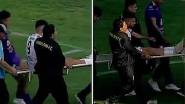 Entra directa en el Top-3 de acciones sucias en el fútbol: lo que sucedió con este jugador en la camilla es de no creer