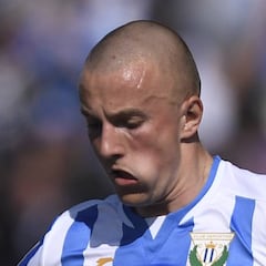 Kravets, una semana mínimo de baja tras destrozarle la nariz