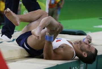 El gimnasta francés se fracturó la tibia de su pierna izquierda tras un mal salto. Sus compañeros no lo pedían creer. La peor imagen de Río 2016.