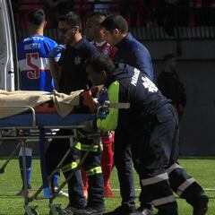 La medida de la UC contra el árbitro tras fractura de Silva