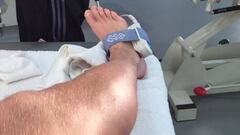 Kroos se quita el yeso y comienza la recuperación