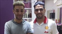 Falcao es noticia en Londres por un tratamiento para su pelo