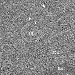 La ciencia descubre un nuevo orgánulo en nuestras células: podría ser clave para luchar contra enfermedades como el Alzheimer