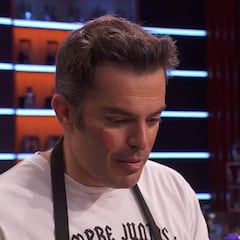 ‘MasterChef’ roza la tragedia y un concursante sufre quemaduras de segundo grado: “Me he abrasado”