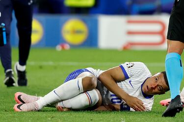 Kylian Mbappé tumbado en el césped tras recibir el impacto que le ocasiona una herida en el tabique nasal.