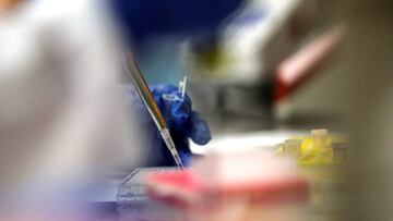 Vacunas a -80 grados centígrados, un desafío enorme para el transporte