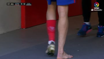 Costa se fue cojeando tras su sustitución por Torres