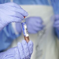 Así son los nuevos síntomas de la variante de COVID Ómicron