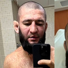 Unos problemas de salud retrasan el regreso de Chimaev