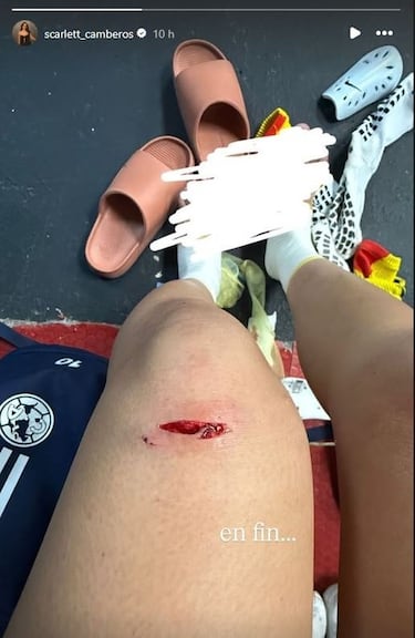 Lesión de Scarlett Camberos en Xolos vs América genera polémica con el arbitraje