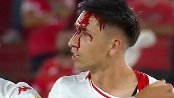 Echeverría fue protagonista de un clásico en Argentina: ¡terminó ensangrentado!