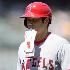 Shohei Ohtani’s agent declares that he will require elbow surgery. How long will he be out and will he play for the Los Angeles Angels again?