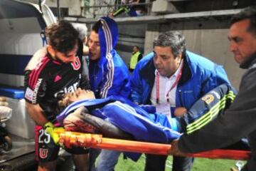 Hinchas de Universidad de Chile sufren un accidente durante el partido contra Audax Italiano por primera division en el Bicentenario de La Florida en septiembre pasado.  