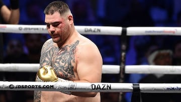 Andy Ruiz sangra de la ceja durante una pelea de box.
