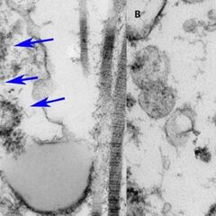 Detectan coronavirus en los testículos de los hombres infectados