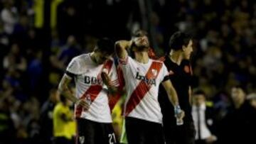 Cuatro jugadores de River Plate con "queratitis química"