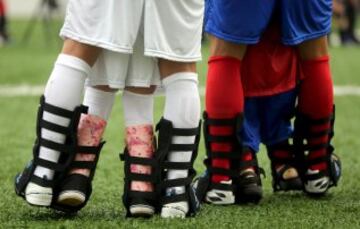 Niños discapacitados participan en un evento deportivo con futbolistas, en Praia Grande (Brasil). El campo de fútbol del Instituto Neymar Jr fue el escenario de la final del campeonato "Bota do Mundo" o "World Boots" , una cita apadrinada por el jugador del Barcelona y disputada por dieciséis niños de la Asociación de Asistencia de Niños Discapacitados (AACD) que hoy vieron realizado el sueño de compartir balón con algunos de sus ídolos.r