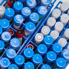 Las cinco vacunas candidatas más seguras