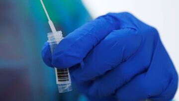 A health care worker performs a fast PCR test in a mobile laboratory truck, amid the coronavirus disease (COVID-19) outbreak, in Soelden, Austria, October 15, 2020.   REUTERS/Leonhard Foeger