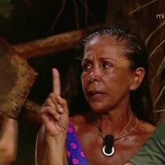 'Supervivientes': Los retoques estéticos de los concursantes