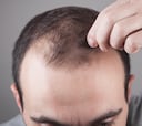 Ni minoxidil ni lociones: este champú con cafeína previene la caída del cabello y arrasa en Amazon España