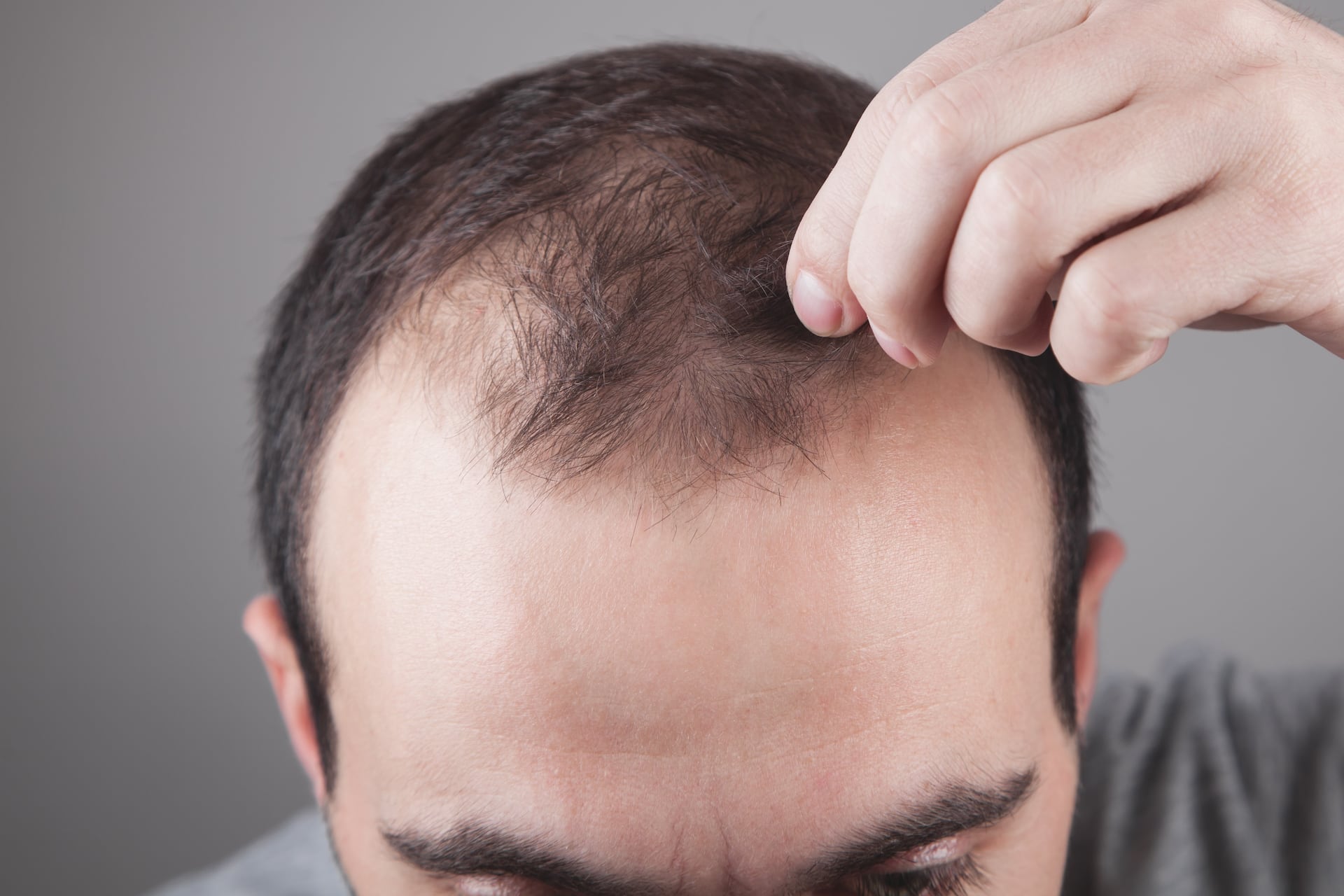 Caucasian man checking his hair. Hair loss problem