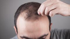 Ni minoxidil ni lociones: este champú con cafeína previene la caída del cabello y arrasa en Amazon España