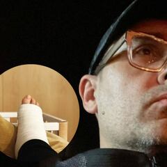 Risto Mejide explica el verdadero motivo de su lesión