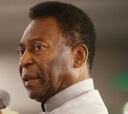 Pelé, sobre los retrasos en las obras: "Es una vergüenza"