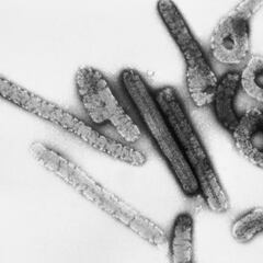 Alarma de la OMS por el virus de Marburgo: estos son los síntomas