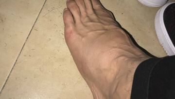 El atacante de Chivas expresó en redes sociales que el arbitraje de Fernando Guerrero no estuvo a la altura para el juego contra Tigres, aunado a la fuerte entrada que recibió y lo habría lesionado.