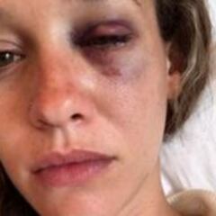 Denuncian agresión en el Pumas vs. Cruz Azul, en CU