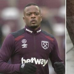 Evra muestra su brutal herida en su debut con el West Ham contra el Liverpool